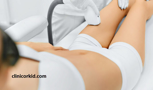 مراقبت های بعد از لیزر موهای زائد ناحیه تناسلی کلینیک ارکید