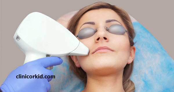 نکات قابل توجه در لیزر موهای زائد کلینیک ارکید