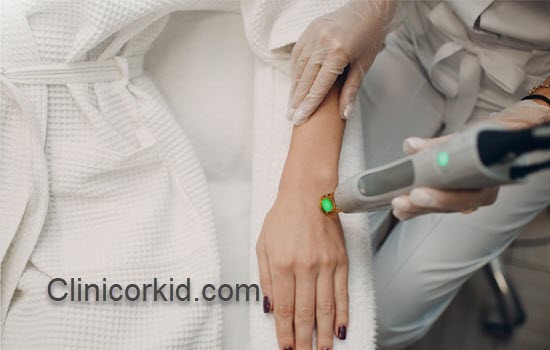 باید ها و نباید های لیزر موهای زائد | کلینیک ارکید