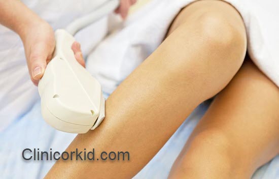 بهترین کلینیک لیزر مو در پونک | کلینیک ارکید