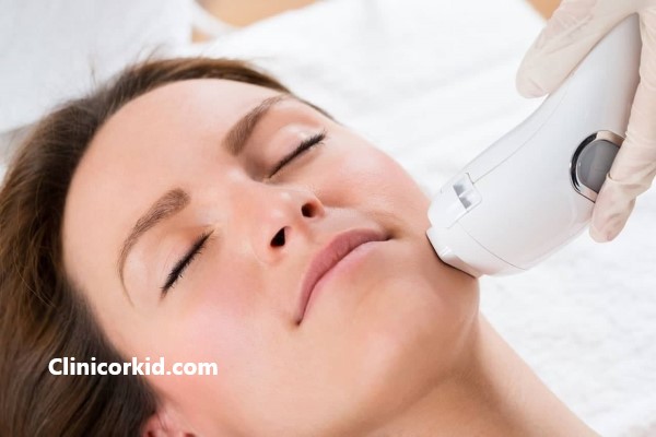 رفع دائمی موهای زائد با دستگاه لیزر الکساندرایت کندلا - کلینیک ارکید