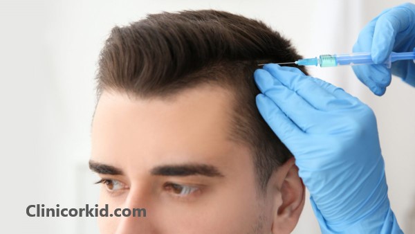 مزوتراپی موی سر چند جلسه است؟ - کلینیک ارکید