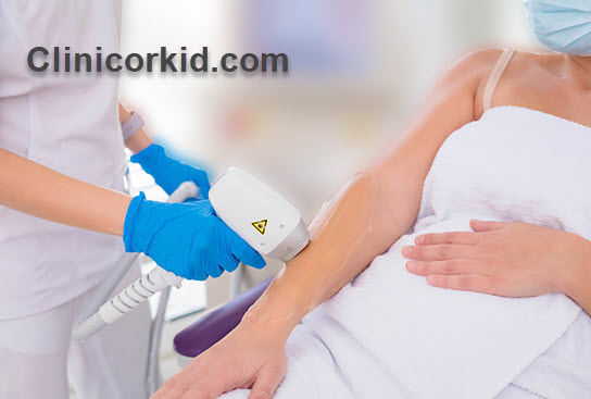 بهترین متخصص لیزر مو در تهران | کلینیک ارکید