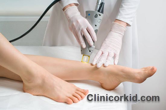 بهترین متخصص لیزر مو در تهران | کلینیک ارکید