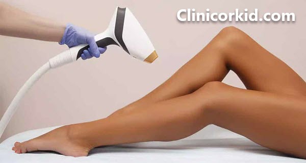 چه کسانی نباید لیزر موهای زائد انجام دهند؟ - کلینیک ارکید