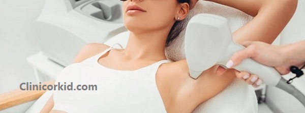 شرایط لیزر موهای زائد | کلینیک ارکید