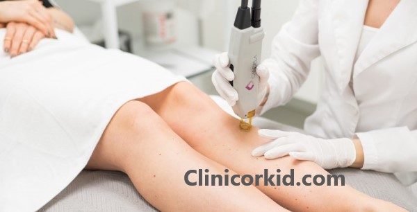 کلینیک لیزر موهای زائد در غرب تهران ویژه بانوان - کلینیک ارکید