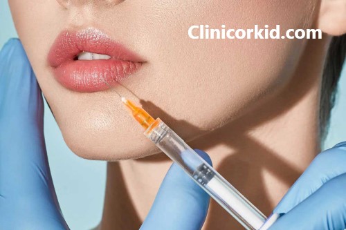 آشنایی با مراقبت بعد از تزریق ژل لب | کلینیک ارکید