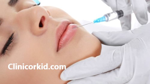 آشنایی با مراقبت بعد از تزریق ژل لب | کلینیک ارکید