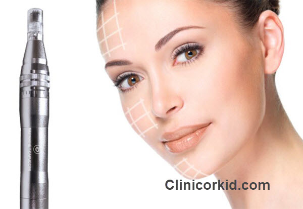 قیمت میکرونیدلینگ صورت چقدر است؟ - کلینیک ارکید