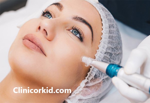 هزینه میکرونیدلینگ صورت در غرب تهران - کلینیک ارکید