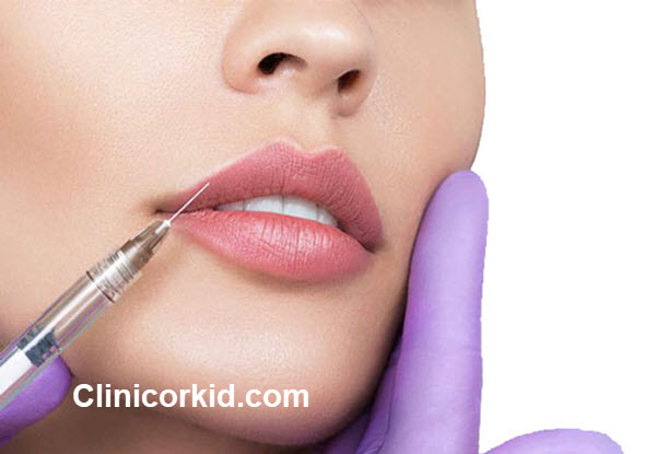 برترین کلینیک تزریق ژل لب در پونک کلینیک ارکید