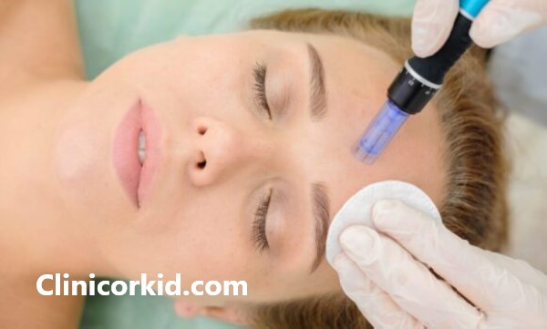 قیمت میکرونیدلینگ صورت در پونک - کلینیک ارکید