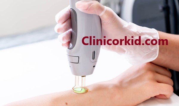 آشنایی با مراحل لیزر موهای زائد کلینیک ارکید