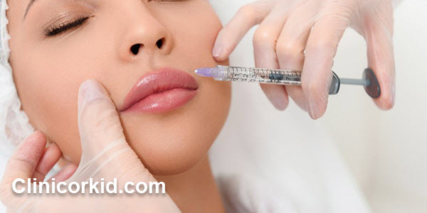 هزینه تزریق ژل چقدر است؟ - کلینیک ارکید