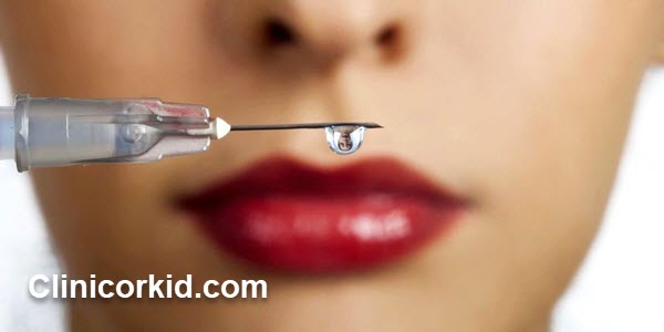 هزینه تزریق ژل چقدر است؟ کلینیک ارکید