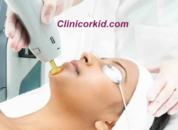 بهترین کلینیک لیزر موی زائد در غرب تهران | کلینیک ارکید