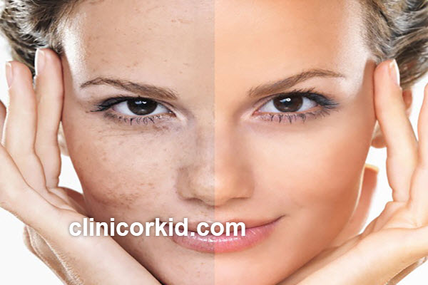 بهترین روش جوان سازی پوست صورت|کلینیک ارکید