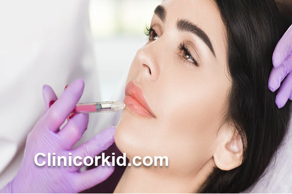 هزینه تزریق ژل لب در غرب تهران چقدر است؟ | کلینیک ارکید