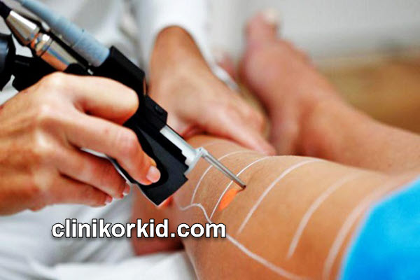 بهترین دستگاه لیزر برای موهای ضخیم | کلینیک ارکید