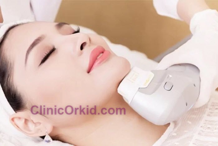 قیمت هایفوتراپی غبغب چقدر است؟ | کلینیک ارکید