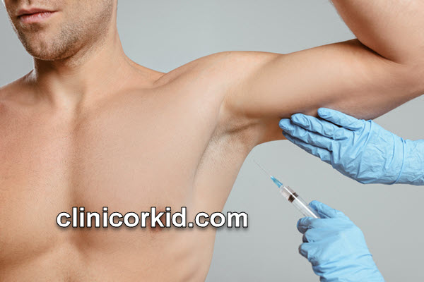 بهترین کلینیک برای بوتاکس زیر بغل در غرب تهران کجاست؟ | کلینیک ارکید