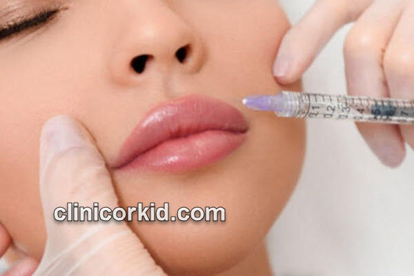 بهترین متخصص تزریق ژل طبیعی در پونک | کلینیک ارکید