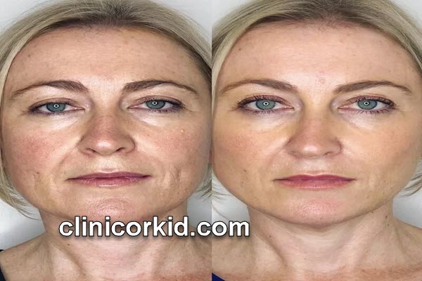 مرکز تخصصی جوانسازی پوست در تهران | کلینیک ارکید