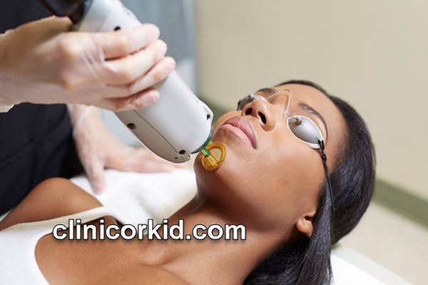 بهترين دستگاه ليزر مو برای پوست های برنزه | کلینیک ارکید