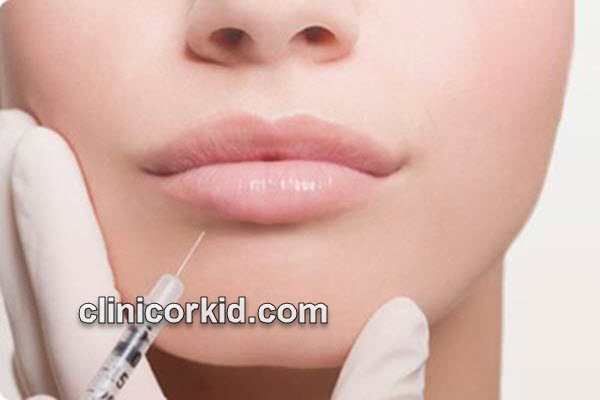 بهترین متخصص تزریق ژل طبیعی در پونک | کلینیک ارکید