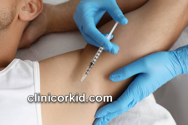 بهترين کلينيک برای بوتاکس زير بغل در غرب تهران کجاست؟ | کلینیک ارکید