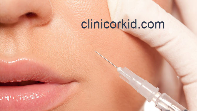 مراقبت های بعد از تزریق ژل خط لبخند | کلینیک ارکید