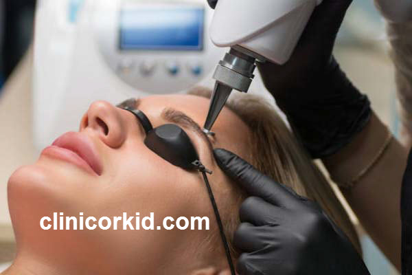 نحوه پاک کردن تتوهای قدیمی با لیزر | کلینیک ارکید