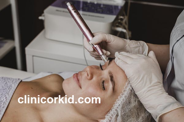 بررسی مزایای میکرو صورت | کلینیک ارکید