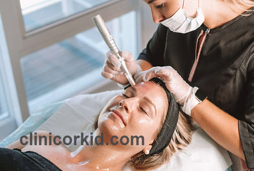 بررسی تعداد جلسات میکرونیدلینگ | کلینیک ارکید