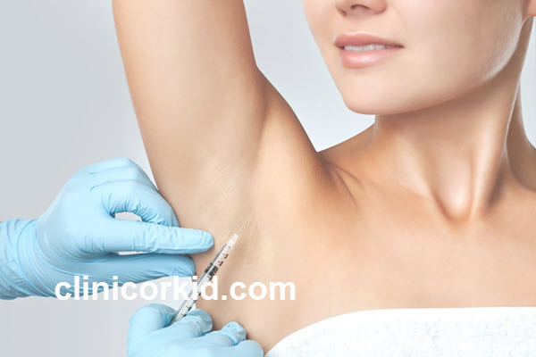 کاندیدای مناسب برای انجام تزریق بوتاکس زیر بغل | کلینیک ارکید