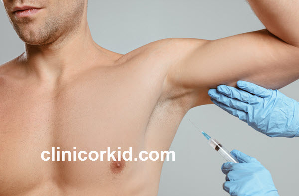 هزینه تزریق بوتاکس زیر بغل چقدر است؟ | کلینیک ارکید