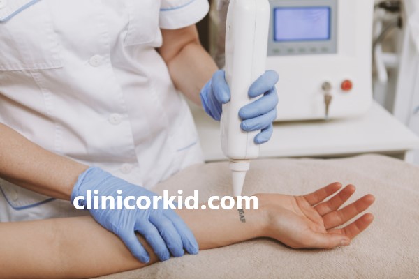 4 راه برای پاک كردن تاتو در يك جلسه | کلینیک ارکید