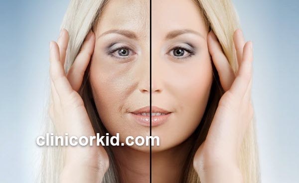 بهترین کلینیک جوانسازی پوست در تهران | کلینیک ارکید