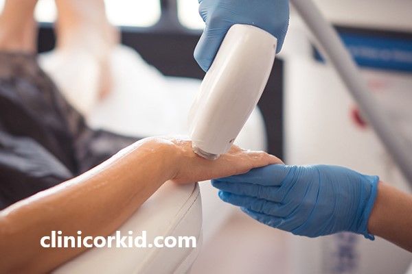لیزر فول بادی با بهترین قیمت | کلینیک ارکید