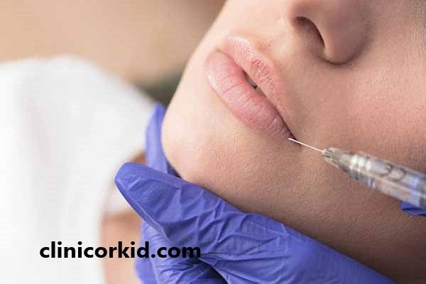 بررسی ماندگاری تزریق ژل در نواحی ممختلف صورت | کلینیک ارکید