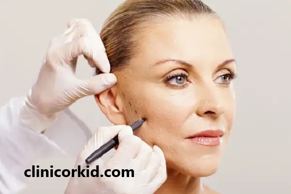 هزینه تزریق ژل به صورت لاغر چقدر است؟ | کلینیک ارکید