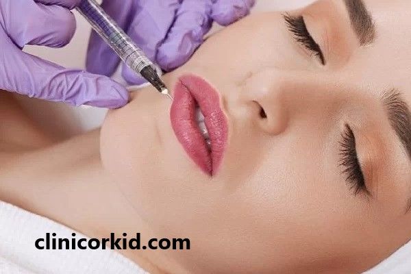 ماندگاری تزریق ژل در نواحی مختلف صورت چقدر است؟ | کلینیک ارکید