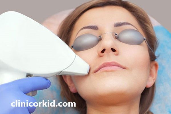 بررسی مهم ترین نکات بعد از لیزر صورت | کلینیک ارکید