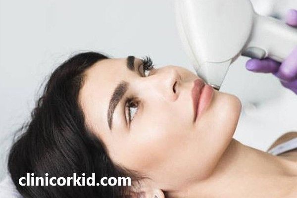 نکات مهم بعد از لیزر صورت | کلینیک ارکید