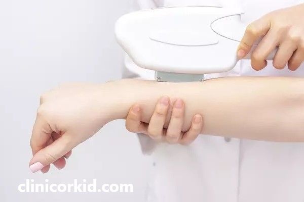 لیزر موهای زائد با بهترین دستگاه | کلینیک ارکید