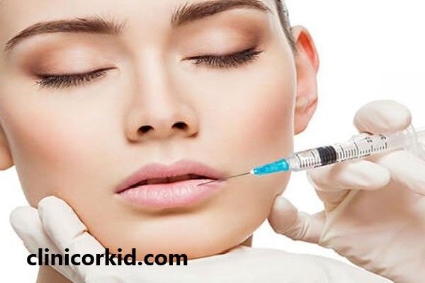 تزریق فیلر لب مدل روسی | کلینیک ارکید