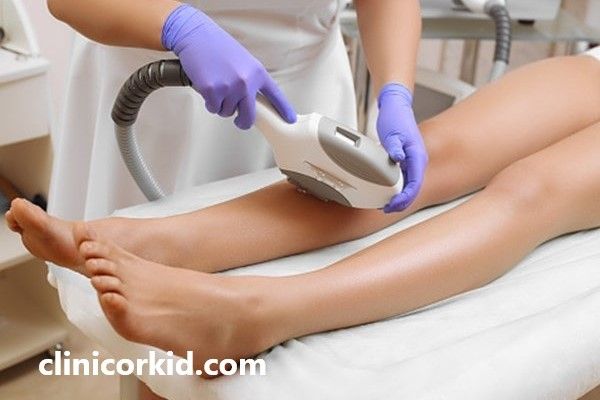 لیزر موهای زائد قبل از بارداری | کلینیک ارکید