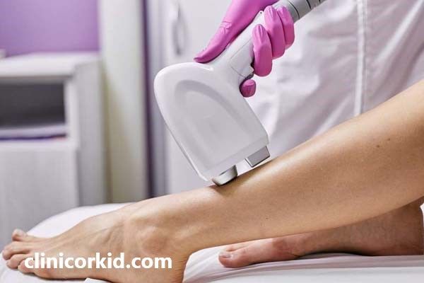 لیزر موهای زائد بدن | کلینیک ارکید