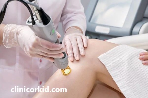بررسی سن مناسب برای لیزر | کلینیک ارکید